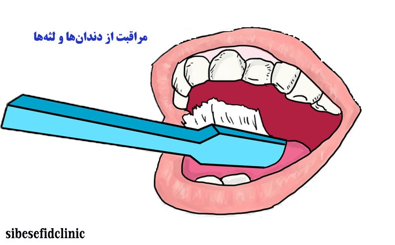 چگونه از دندان و لثه خود مراقبت کنیم؟